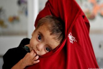 WFP: Three million Afghanistani children severely malnourished