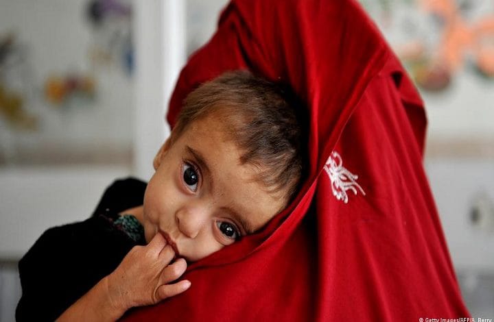 WFP: Three million Afghanistani children severely malnourished