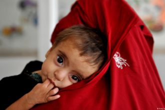 Over 700 Children in Panjshir Province Suffer from Malnutrition Due to Poverty in Afghanistan