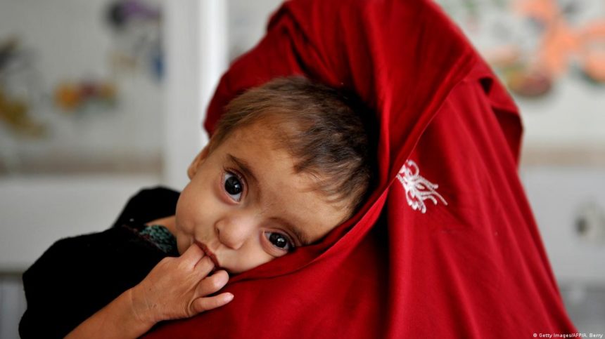 Over 700 Children in Panjshir Province Suffer from Malnutrition Due to Poverty in Afghanistan